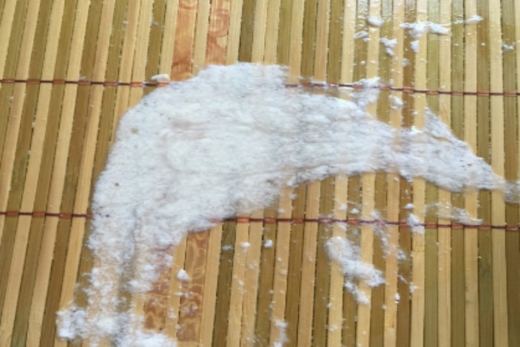 颅内压增高呕吐物呈豆腐渣样图