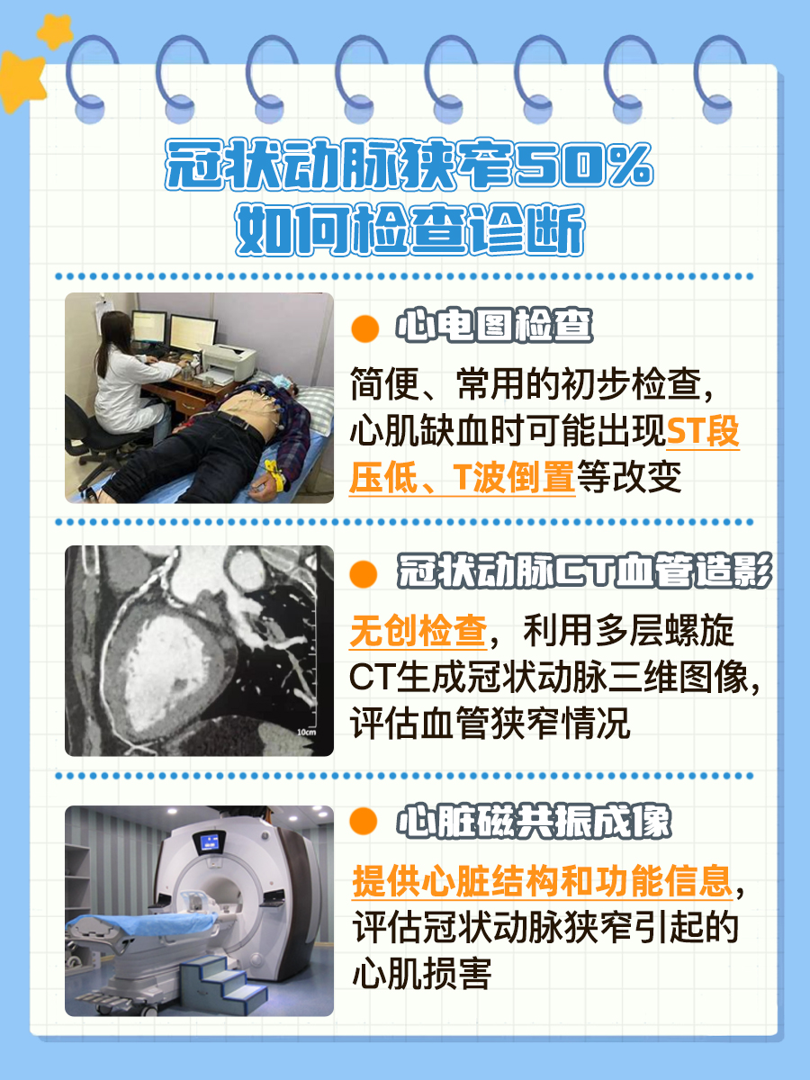 冠状动脉狭窄50%是否严重？一文揭晓