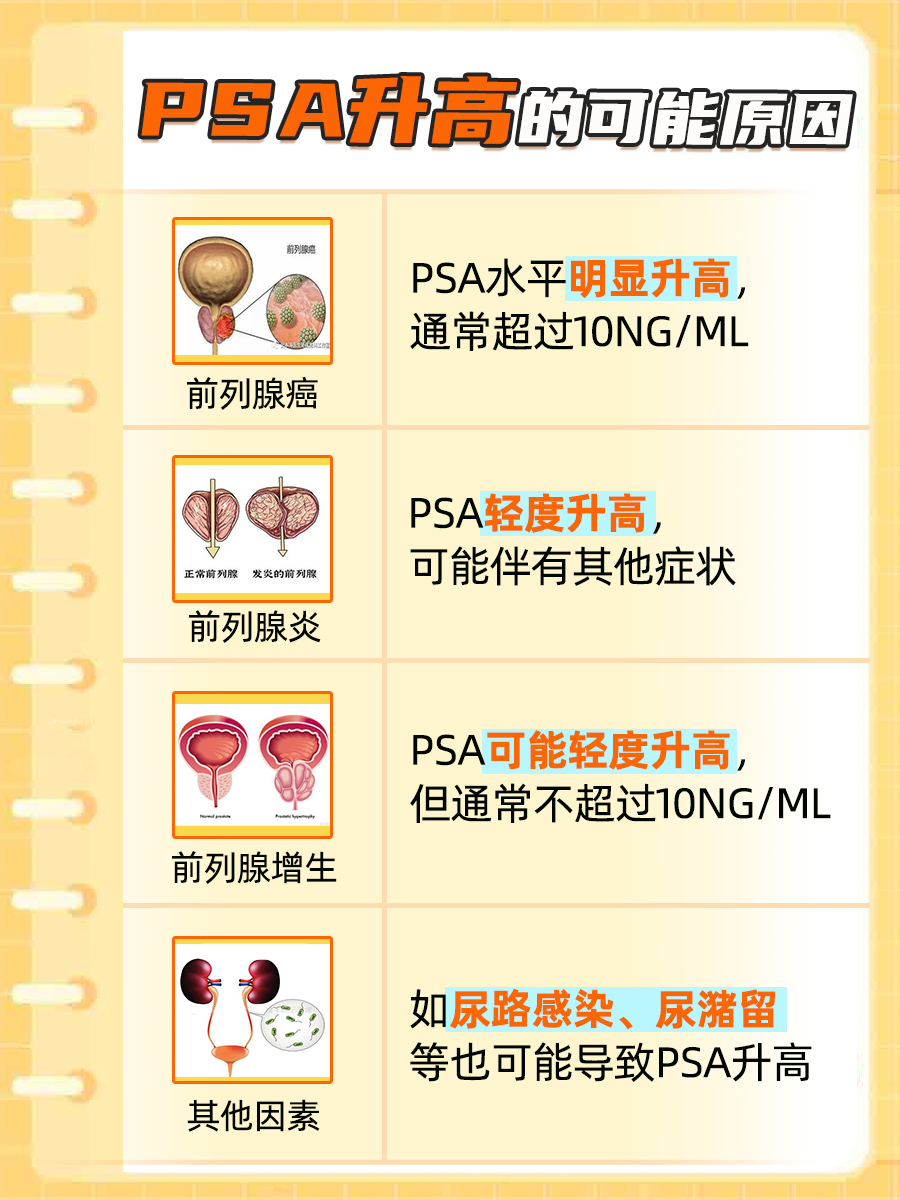 前列腺特异抗原7.68ng/ml，严重吗？