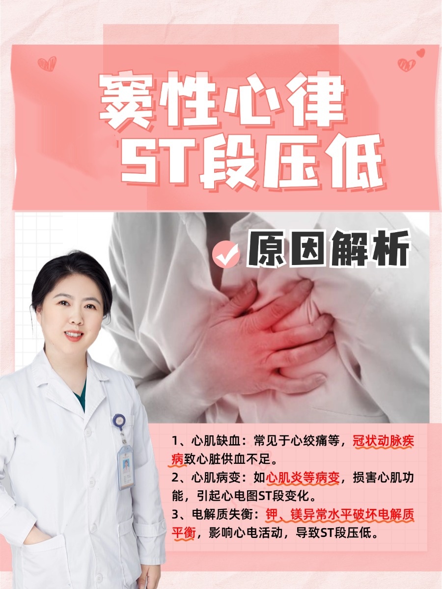 窦性心律ST段压低,原因解析