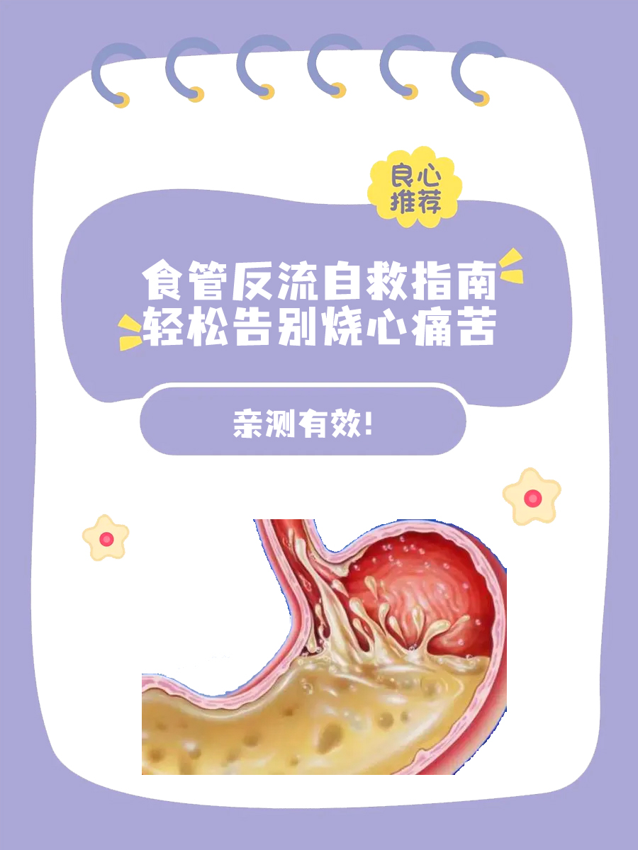 亲测有效！食管反流自愈的最佳方法