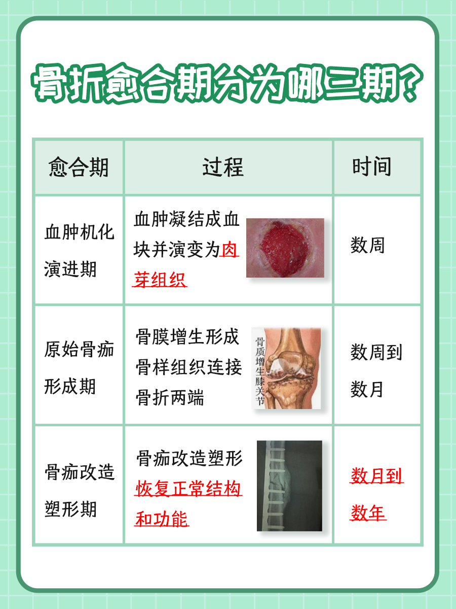 揭秘：骨折愈合期分为哪三期