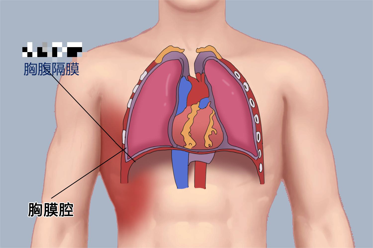 胸腹隔膜位置图 胸腹隔膜位置图