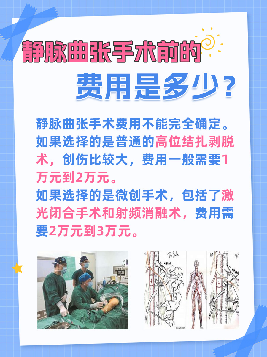 揭秘！静脉曲张手术费用大公开