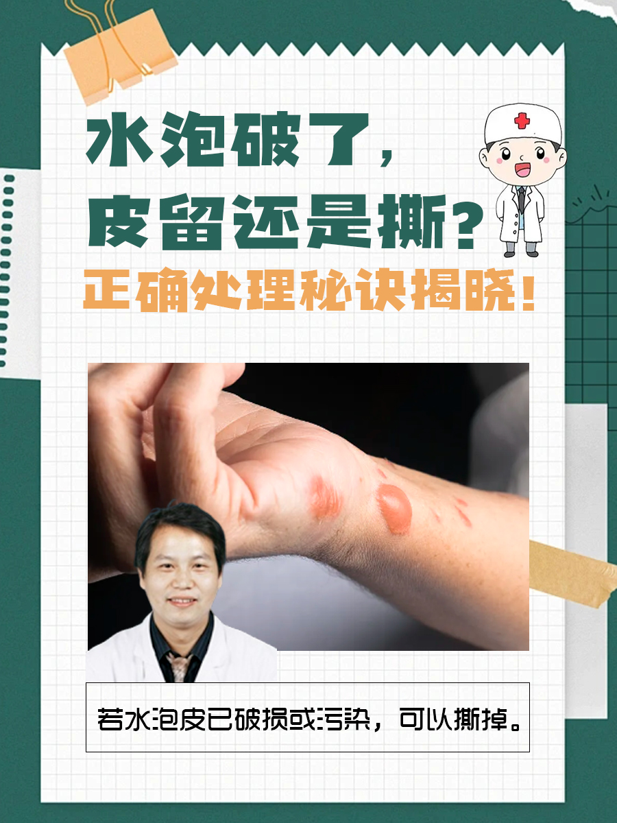 水泡破了，皮留还是撕？正确处理秘诀揭晓！