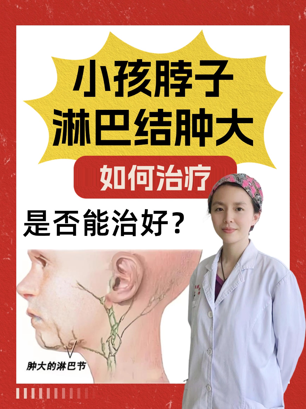 小孩脖子淋巴结肿大，如何治疗，是否能治好？