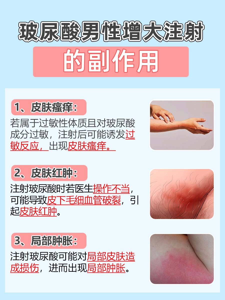 医生解答:玻尿酸男性增大注射要多少钱