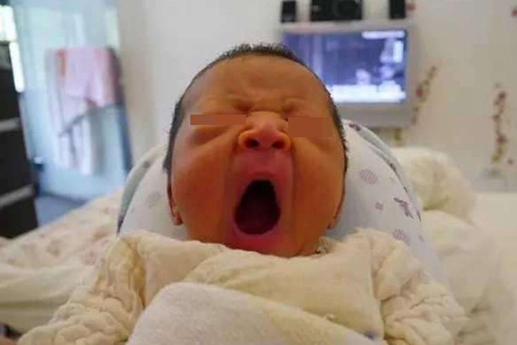 新生儿皮肤黄染图