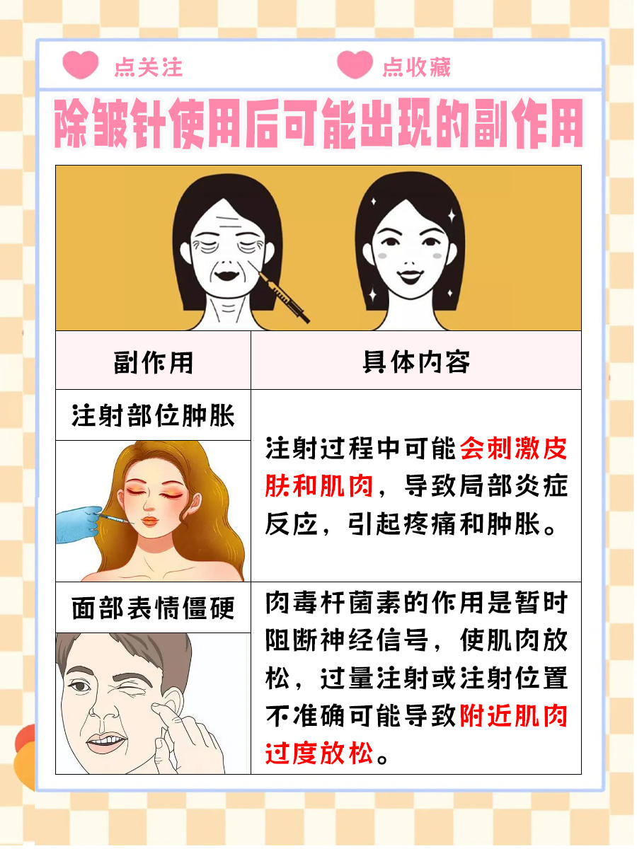 除皱针视力模糊恢复期 ,你知道多久吗?