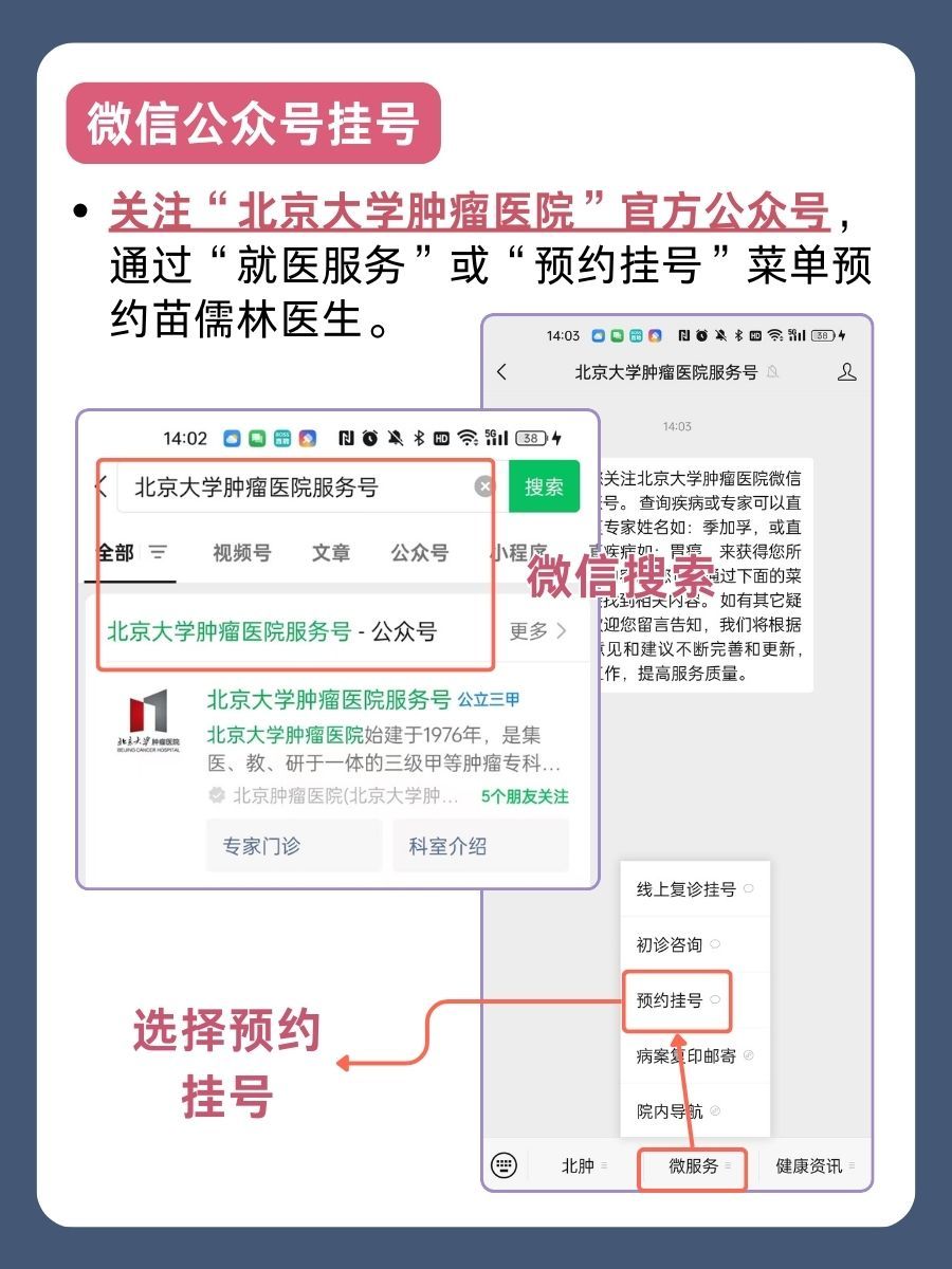北京大学肿瘤医院苗儒林医生怎么样？怎么挂号？