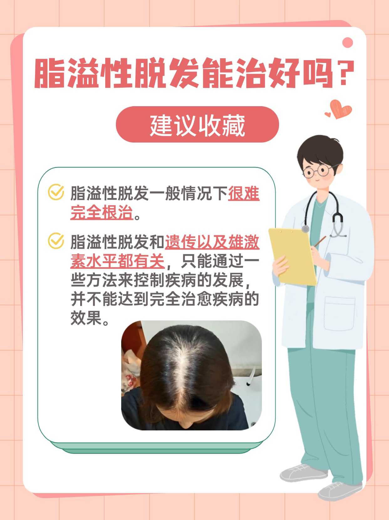 脂溢性脱发能治好吗？答案来了