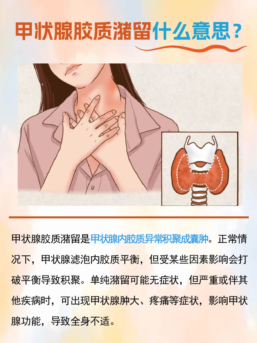 一文了解—甲状腺胶质潴留是什么意思