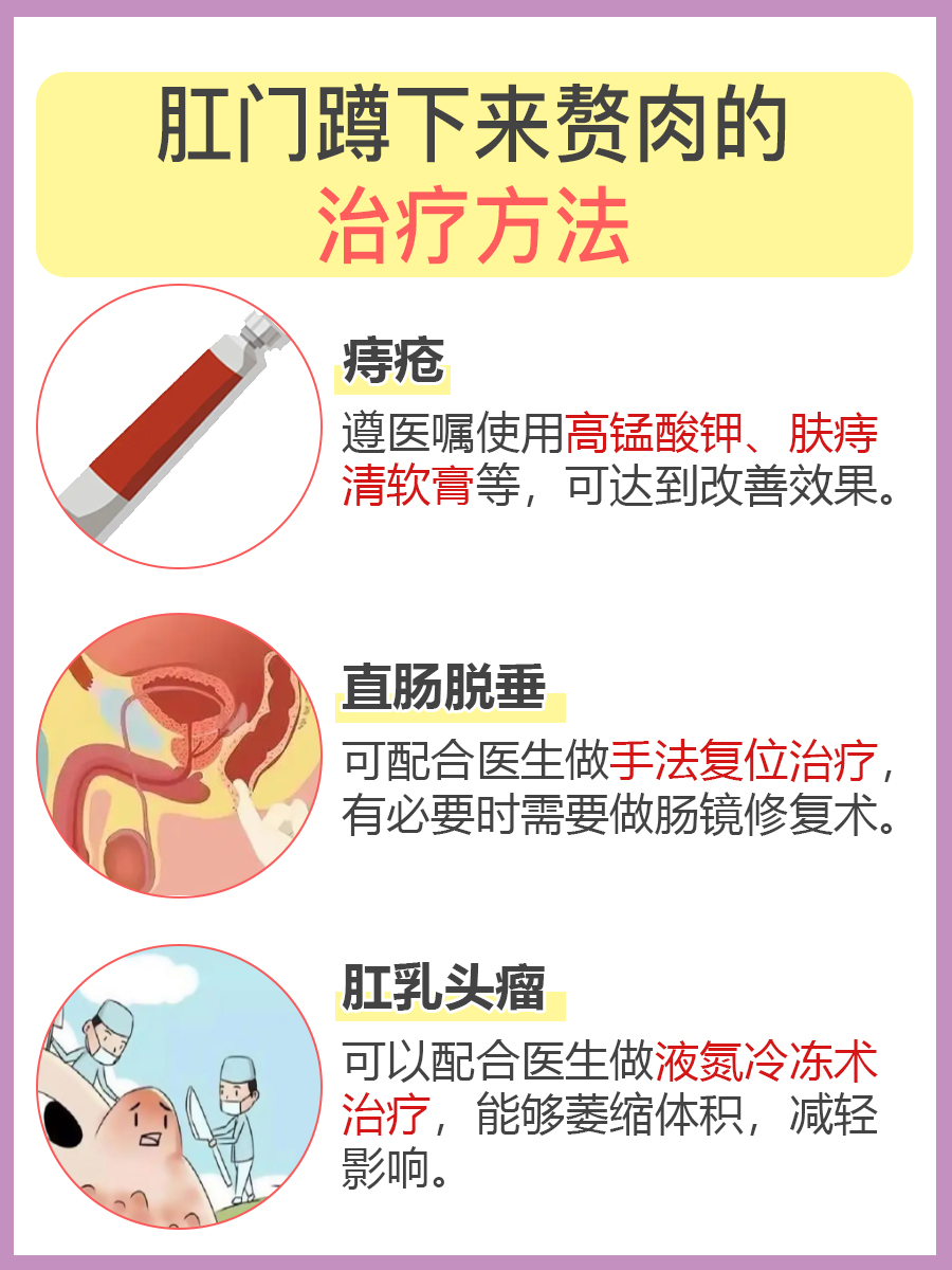 医生告诉你：一蹲下去肛门就有一坨肉出来的原因