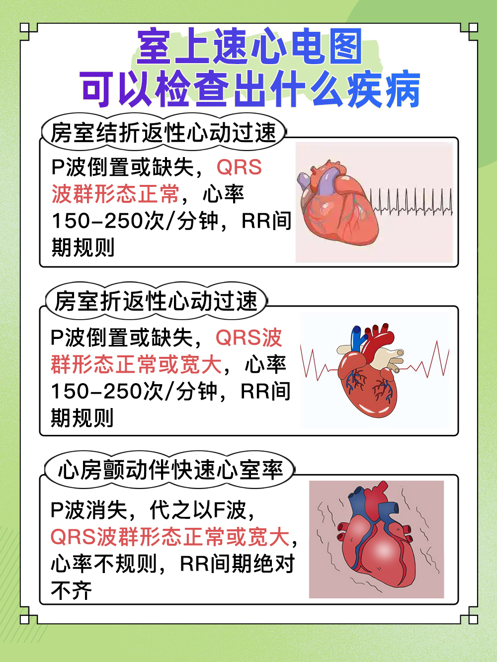 室上速心电图特征，快速识别心律失常！