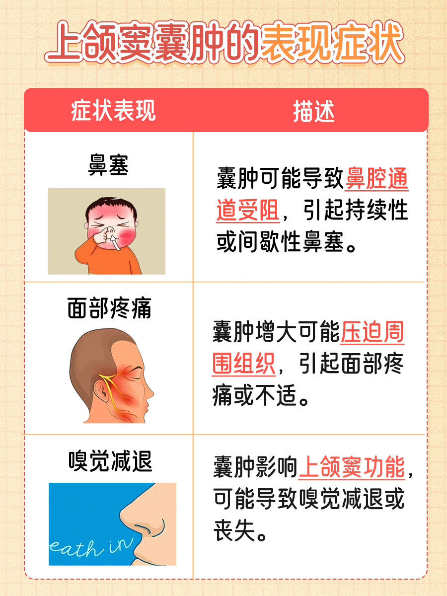 上颌窦囊肿怎么治疗？一文告知