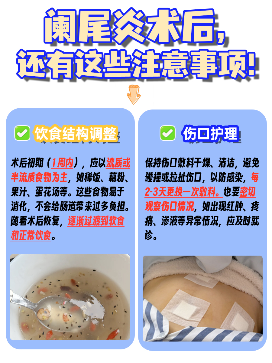 一文说清！阑尾术后多久，才能重新吸烟？