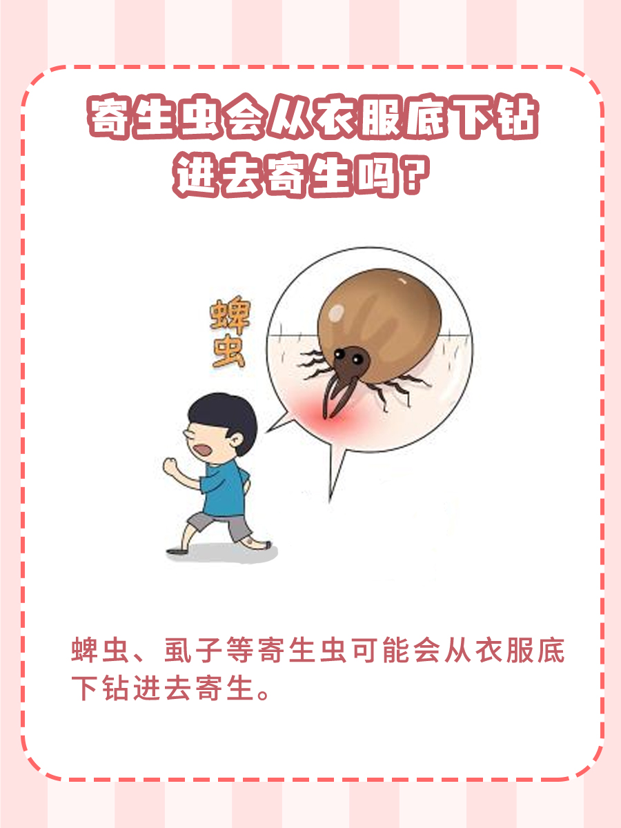 医生大揭秘！寄生虫会从衣服底下钻进去寄生吗？