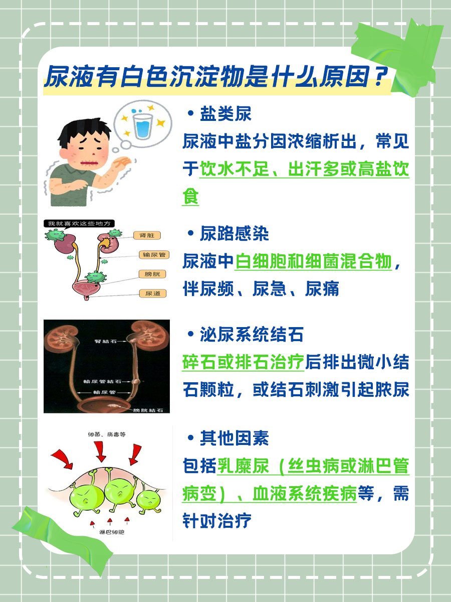 尿液异象揭秘:白色沉淀物的隐藏含义!