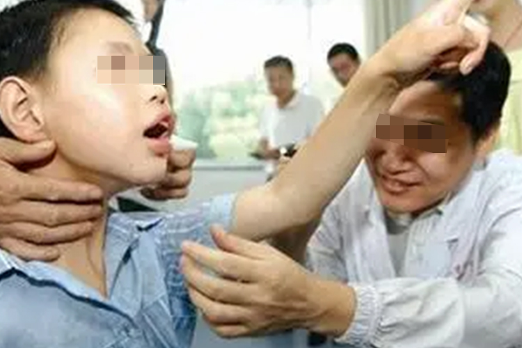 癫痫强直性发作图 癫痫强直性发作图