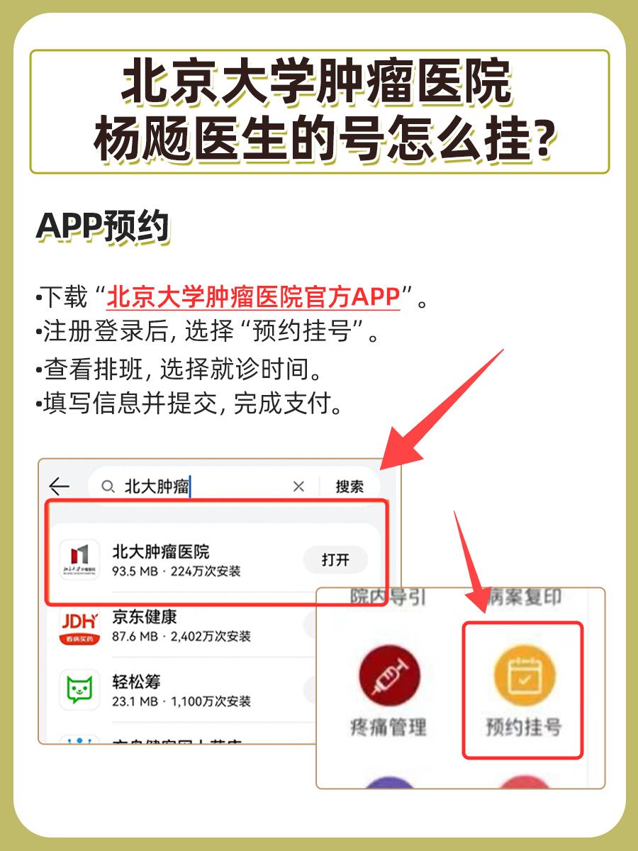 北京大学肿瘤医院杨飏医生怎么样?怎么挂号?