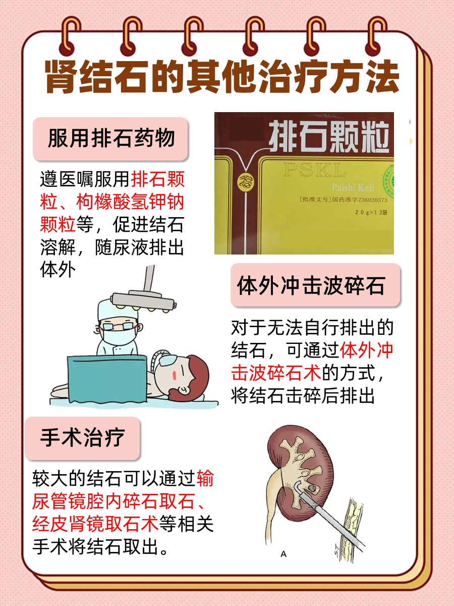 肾结石消炎攻略：科学选择，哪些药物最有效？