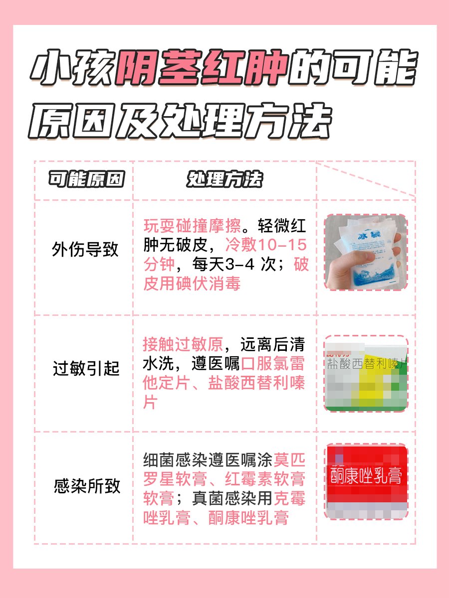 小孩鸡儿红肿怎么办？一文大揭秘