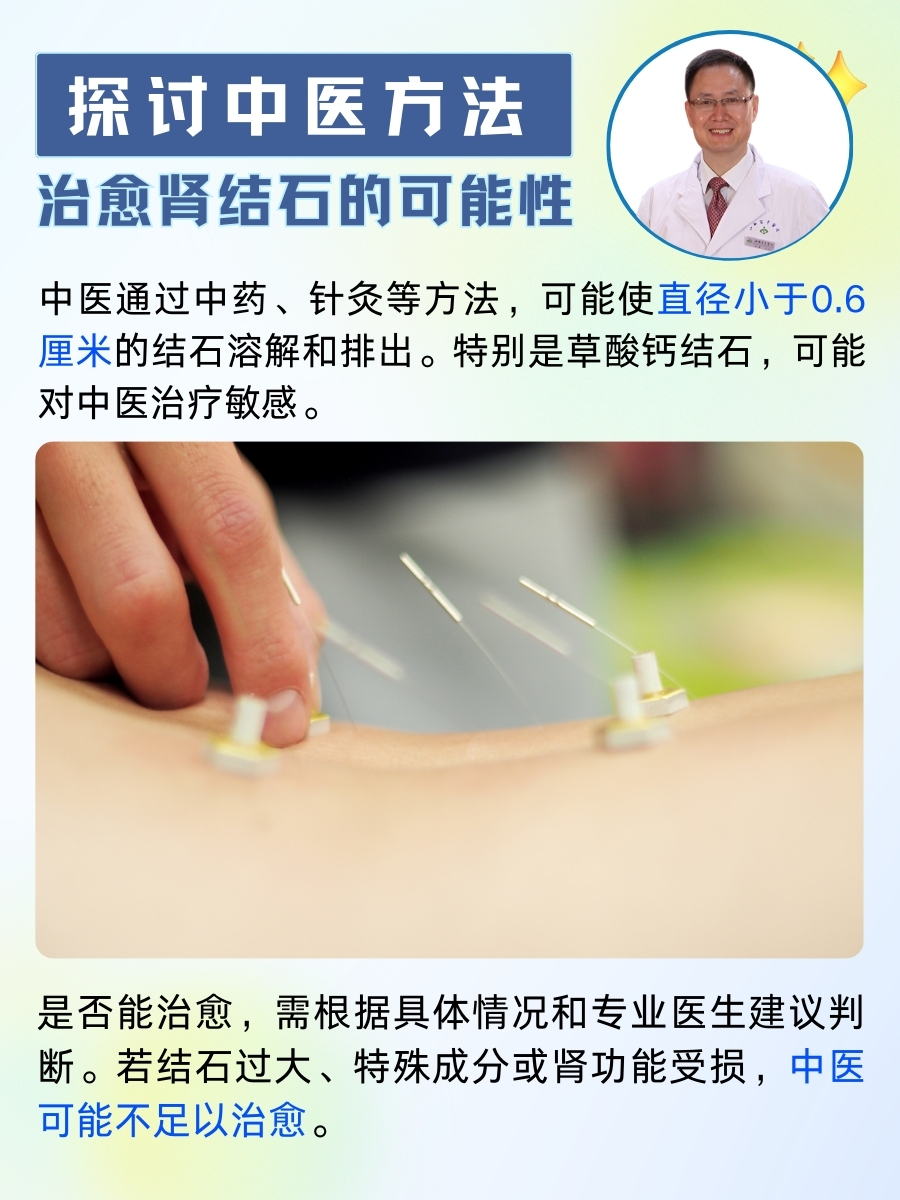 探讨中医方法治愈肾结石的可能性