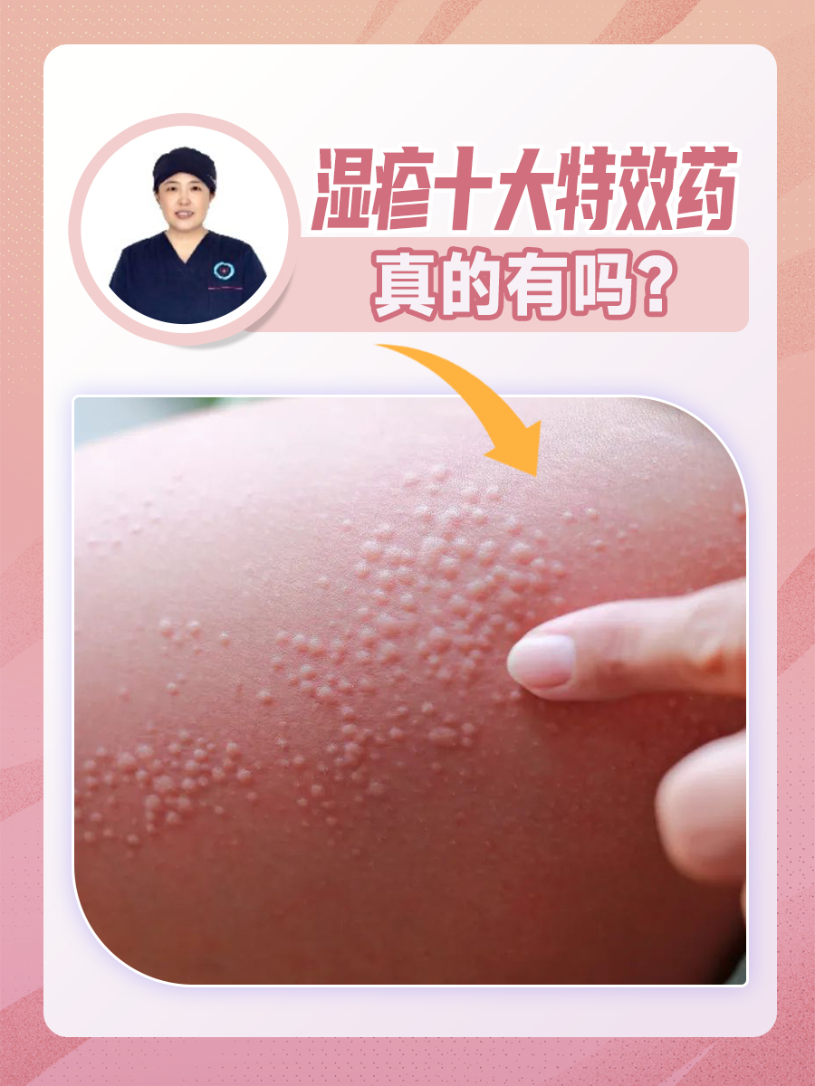 湿疹十大特效药，真的有吗？