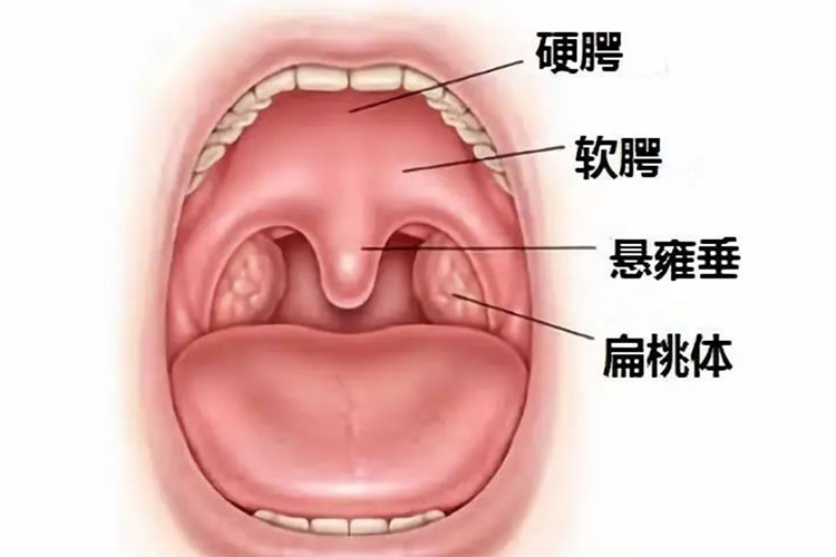 口腔腭侧位置图