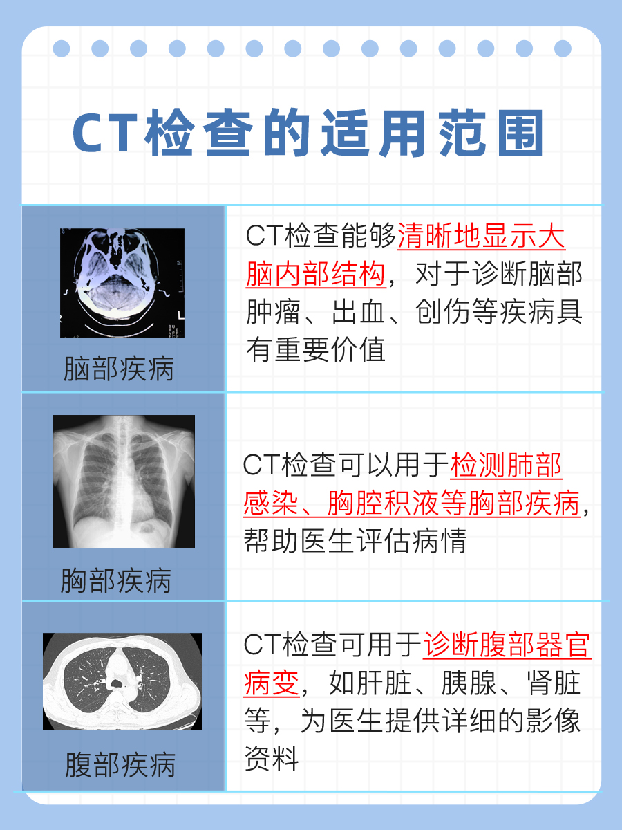 医生解答：CT检查要多久才能出具结果