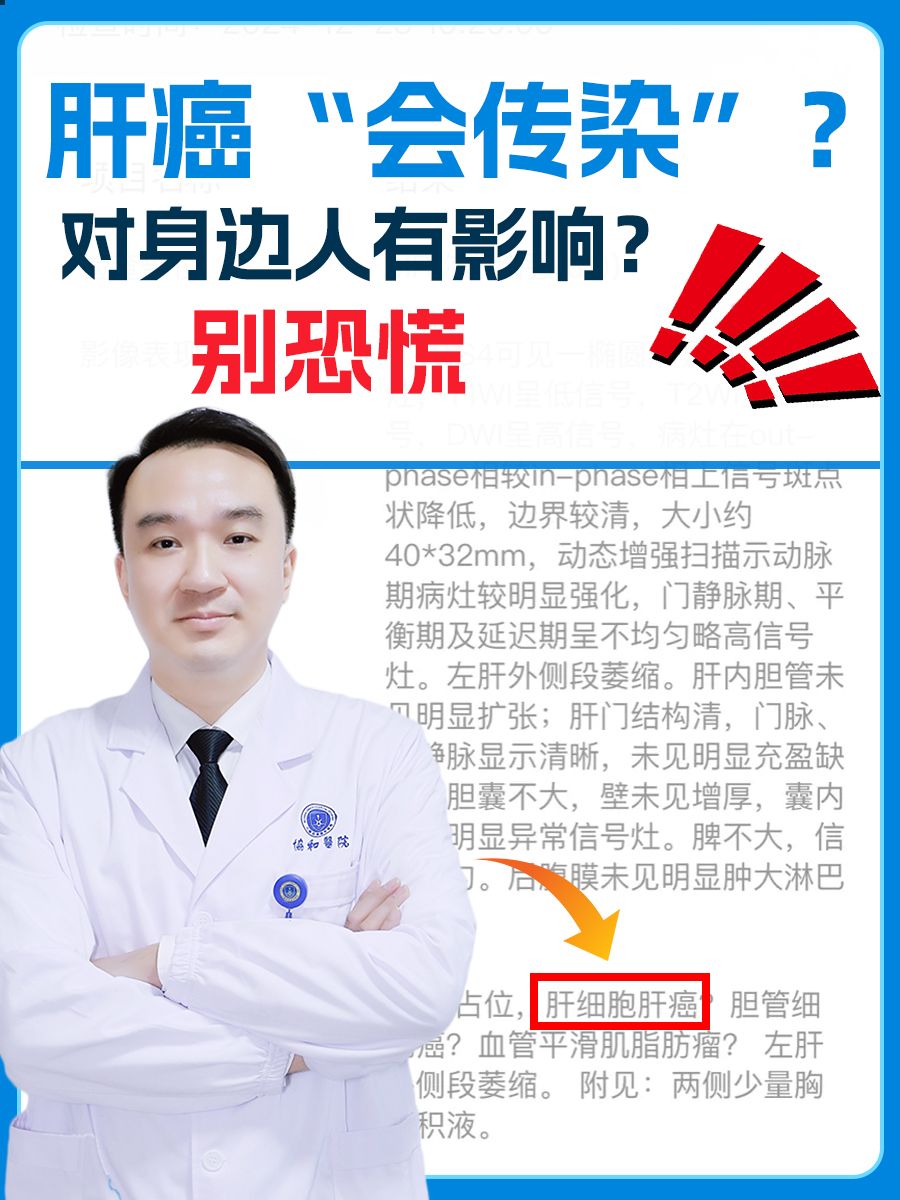 肝癌“会传染”？对身边人有影响？别恐慌！