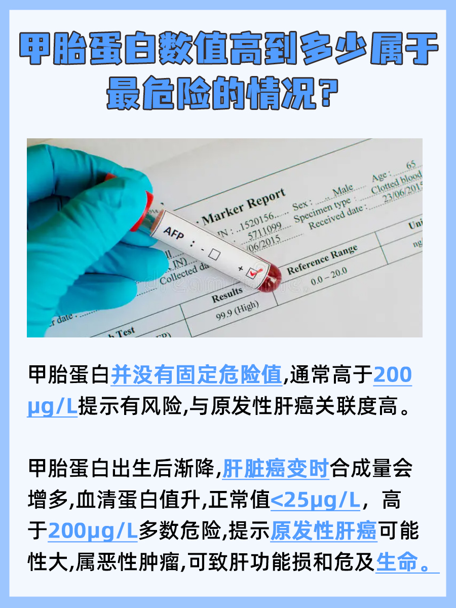 快来查看：甲胎蛋白高到多少是最危险的？