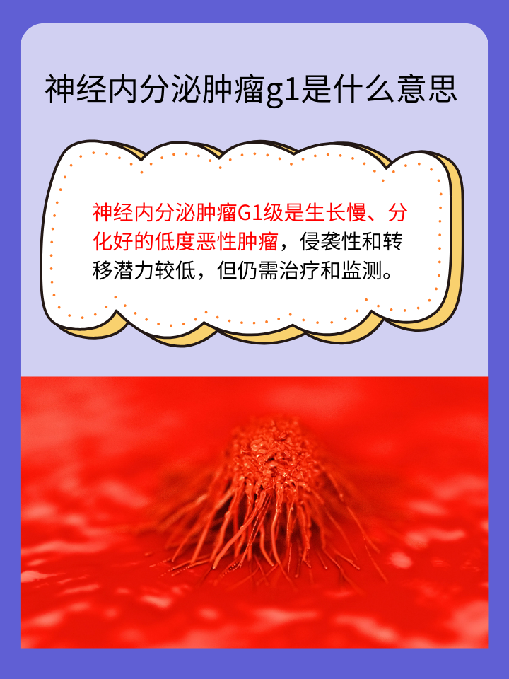 神经内分泌肿瘤G1：探究癌症的轻重缓急