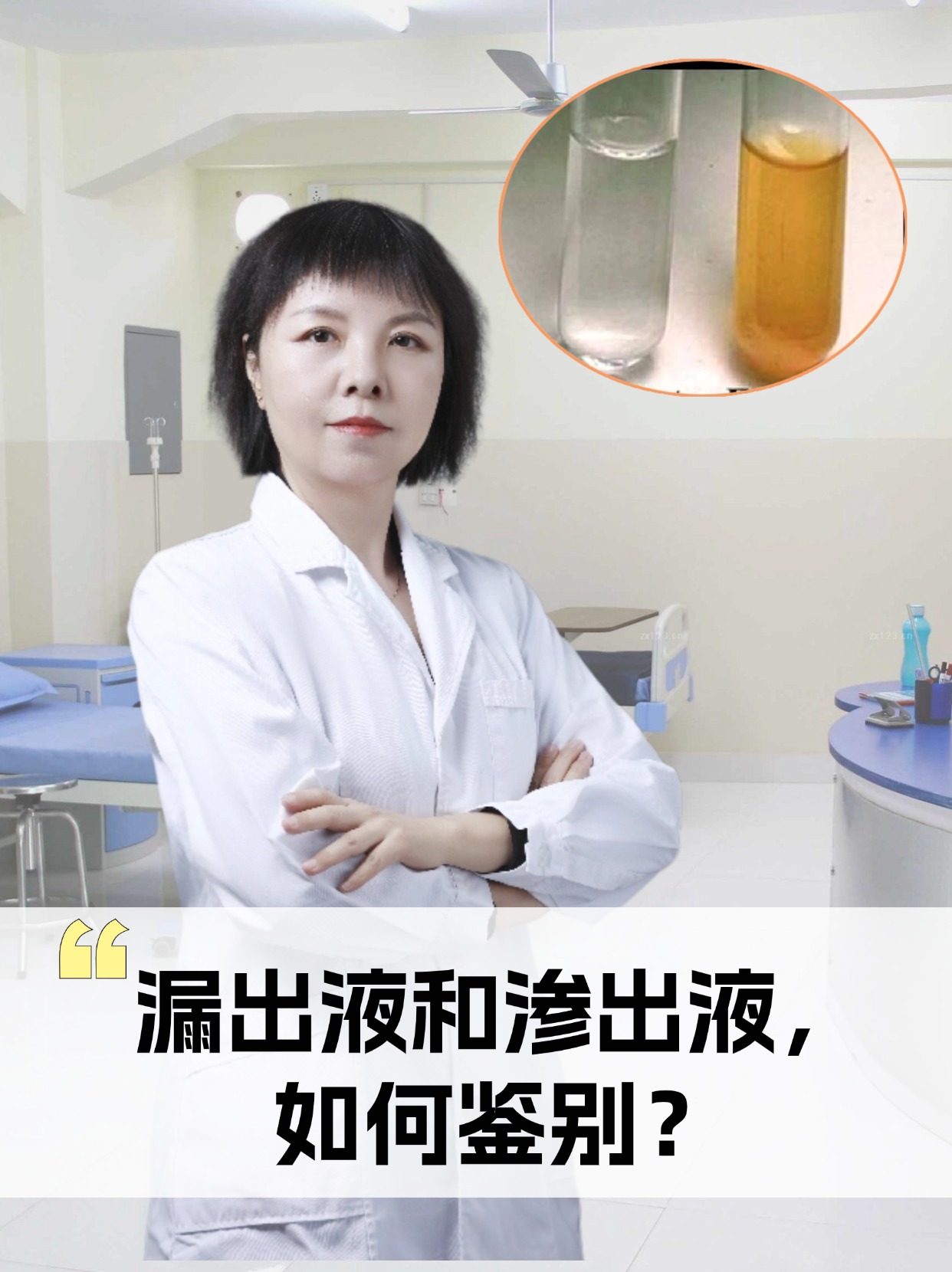 漏出液和渗出液，如何鉴别？