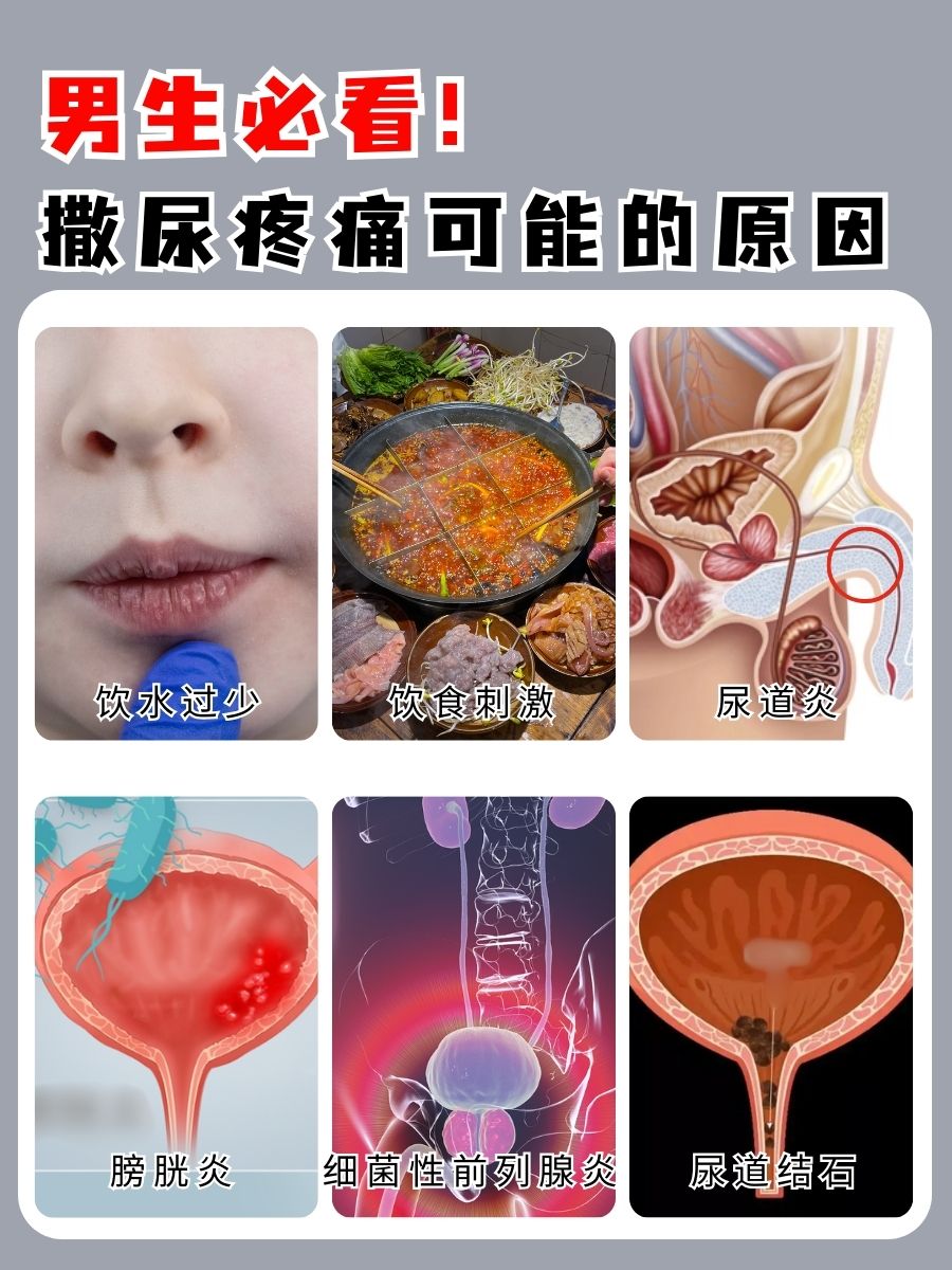男生必看！撒尿疼痛可能的原因