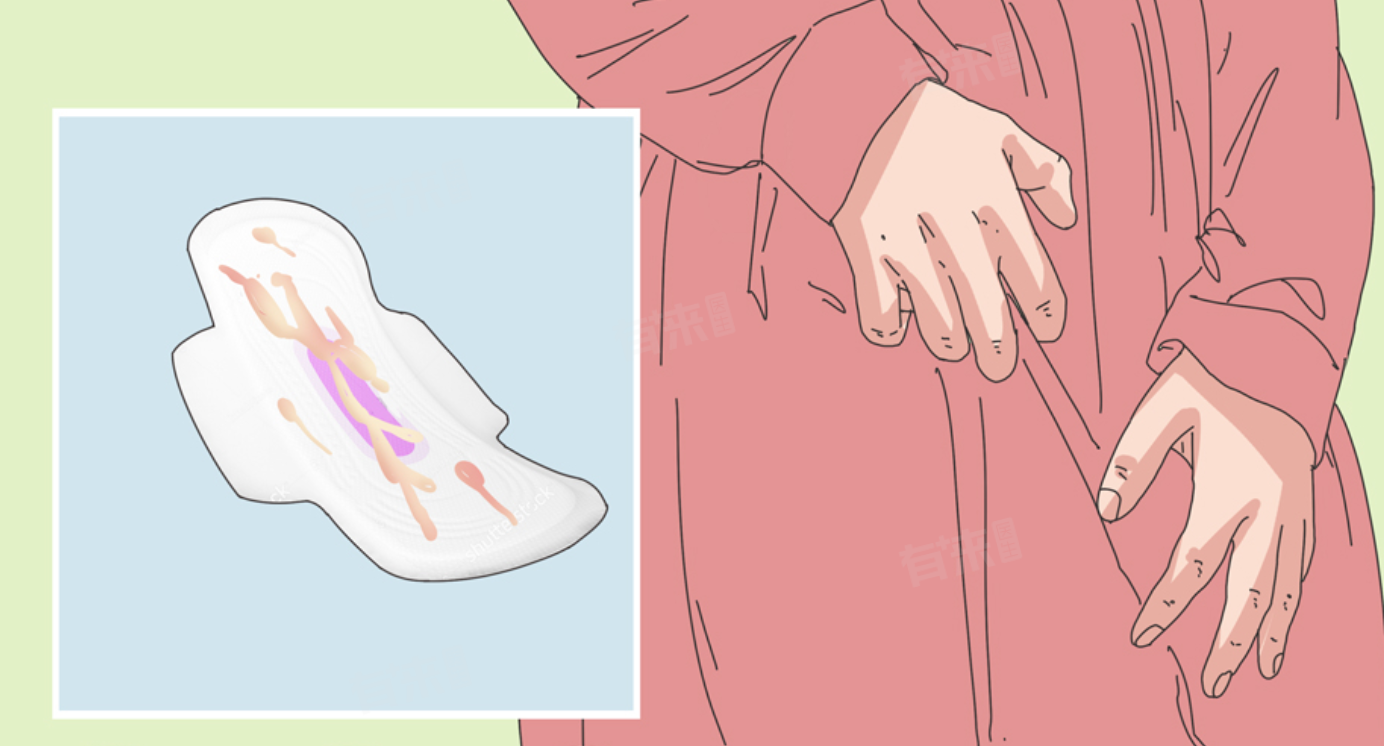 女性不规则出血是什么原因引起的-有来医生