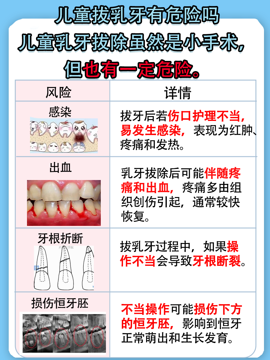 儿童乳牙拔除，危险是否悄然逼近？