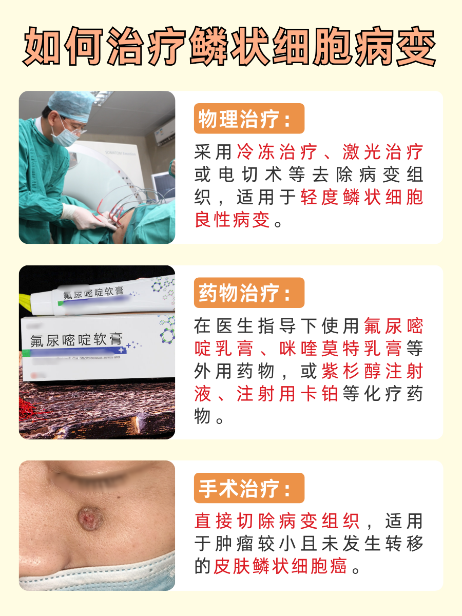 鳞状细胞解析，你关心的都在这里！