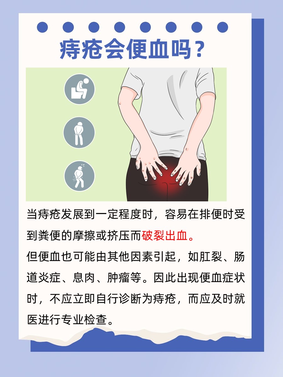 痔疮便血知多少？科学应对