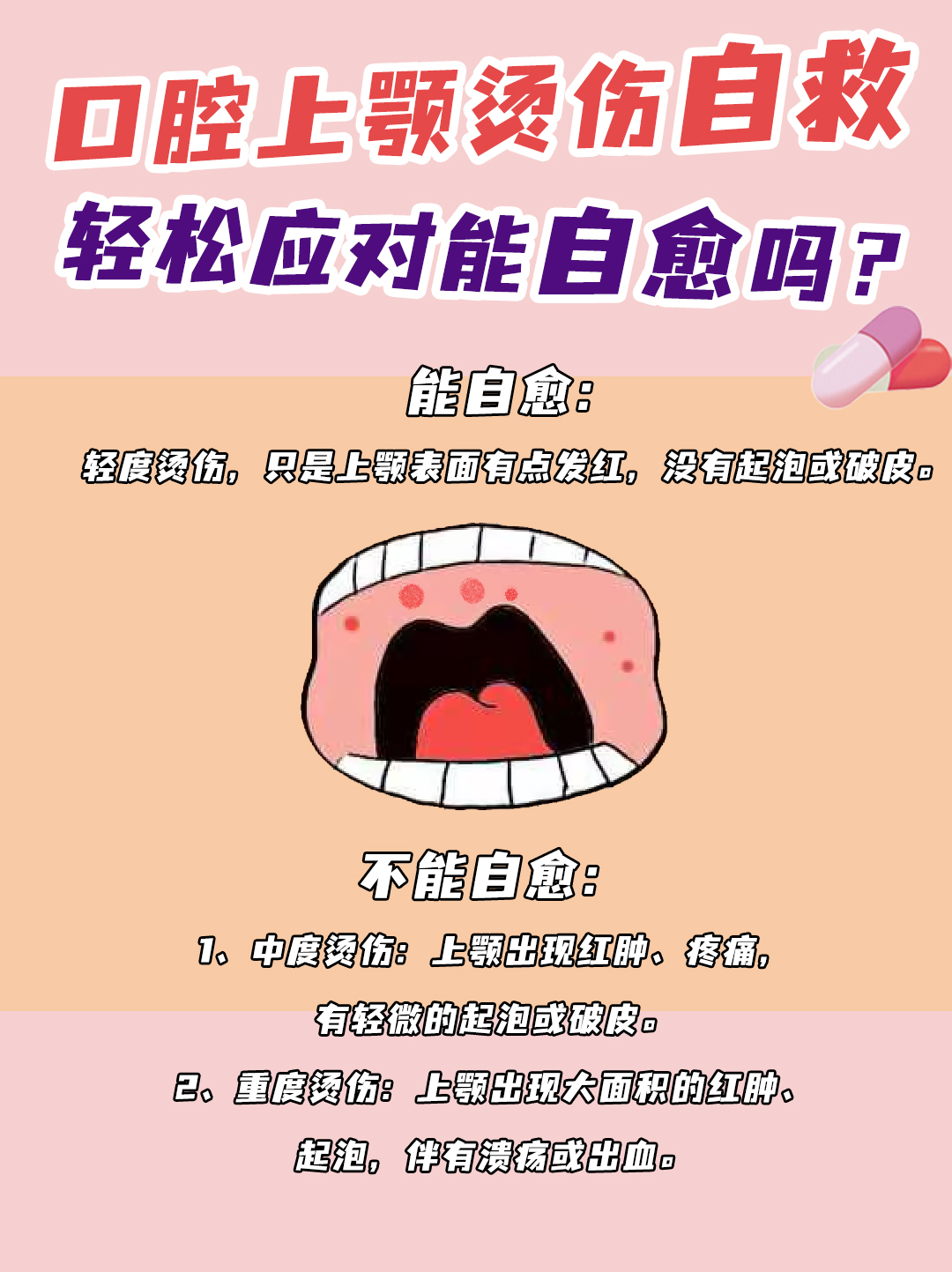 口腔上颚烫伤自救，轻松应对能自愈吗？