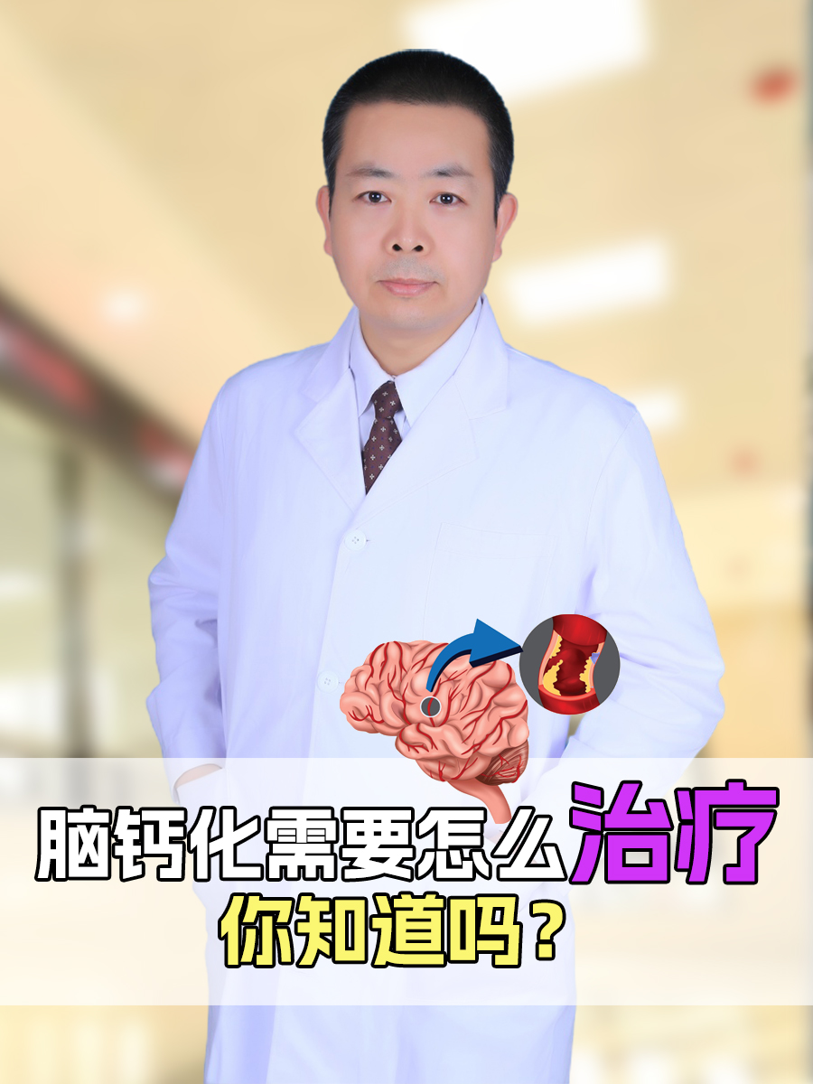 脑钙化需要怎么治疗,你知道吗?