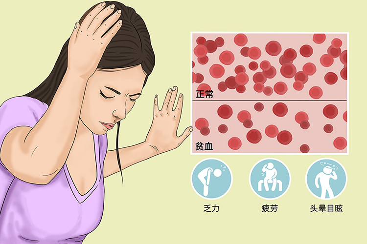 贫血症状图