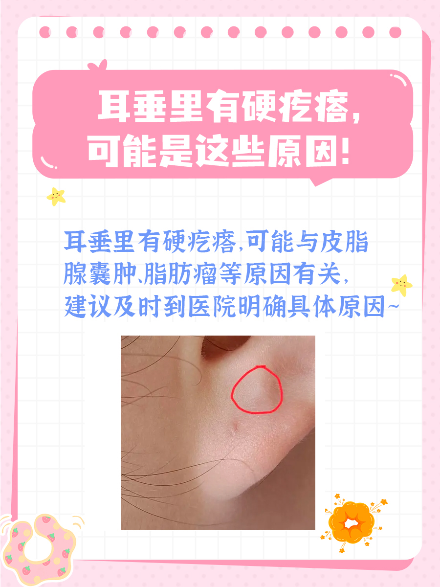 耳垂里有硬疙瘩，可能是这些原因！