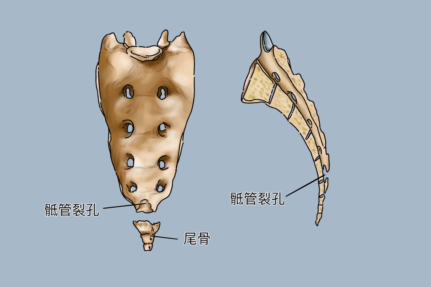 骶管解剖图片