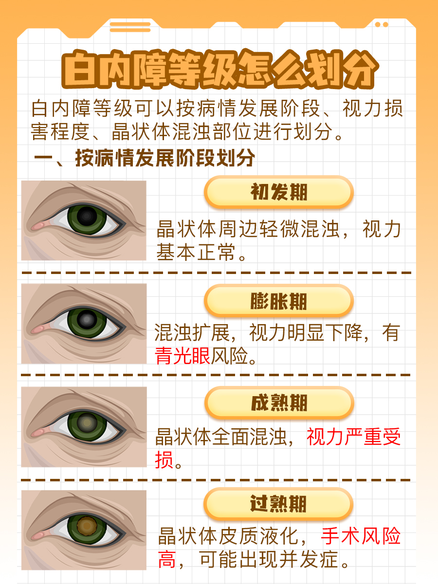 白内障等级划分：科普解析