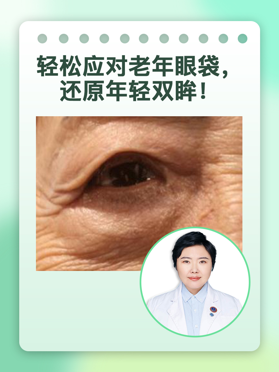 轻松应对老年眼袋，还原年轻双眸！