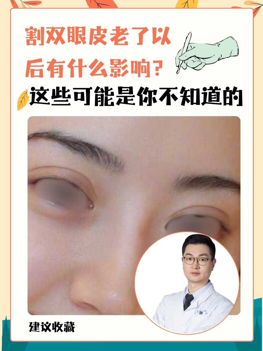 割双眼皮老了以后有什么影响？这些可能是你不知道的