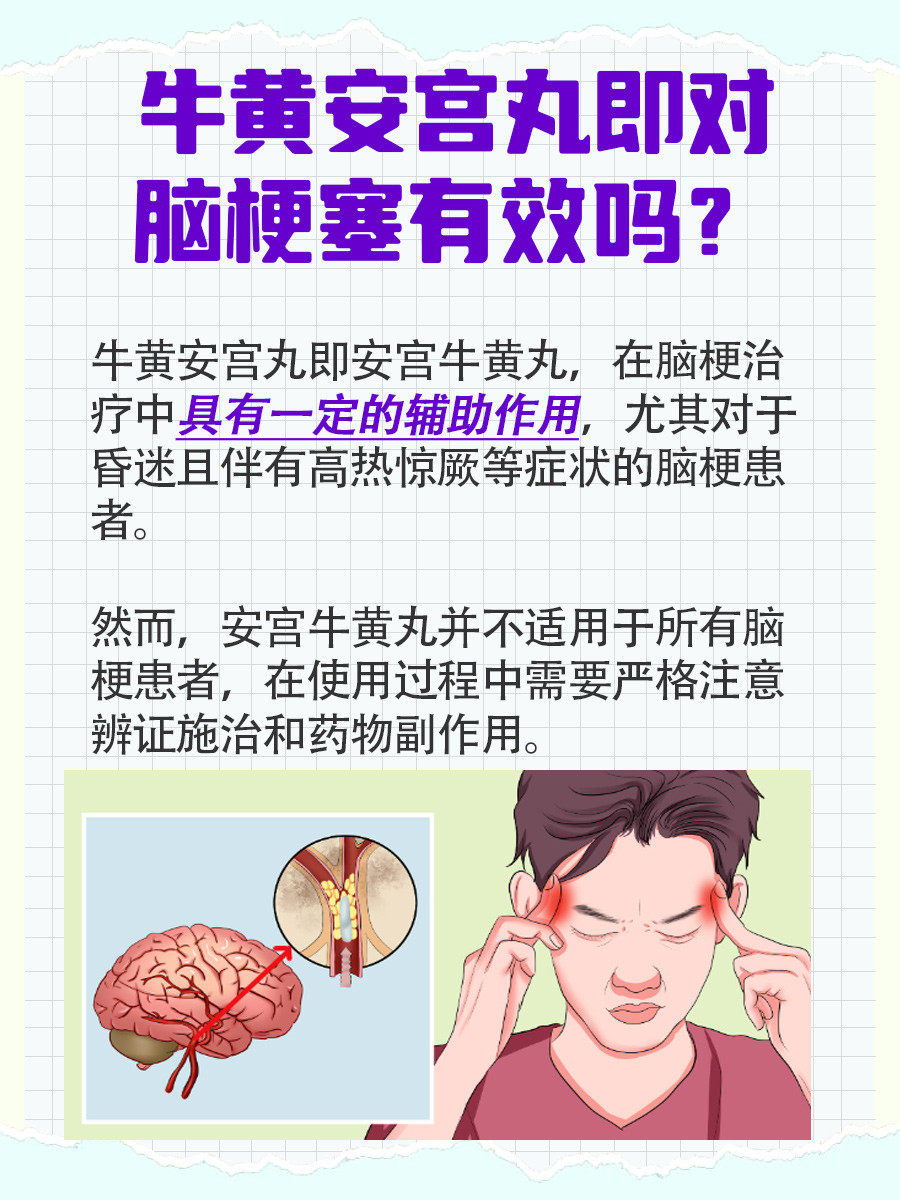 安宫牛黄丸：对脑梗塞是否有效？