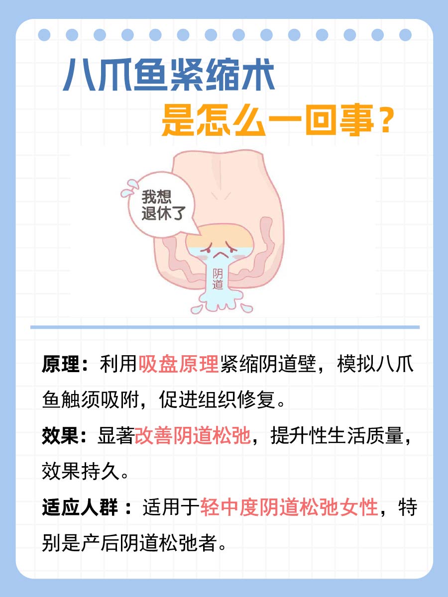 揭秘！八爪鱼紧缩术是什么？