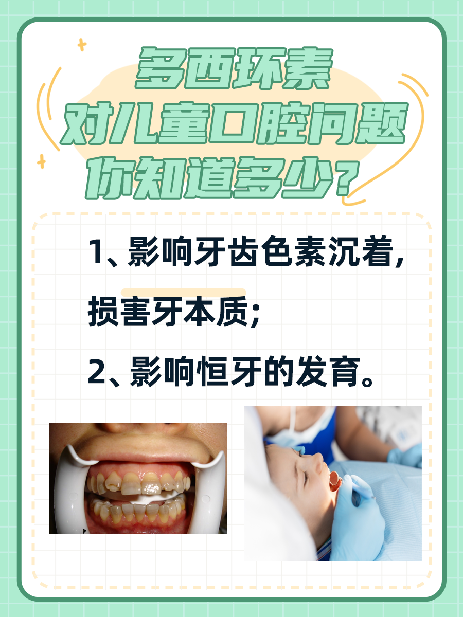9岁孩子吃7天多西环素，牙齿会怎样？
